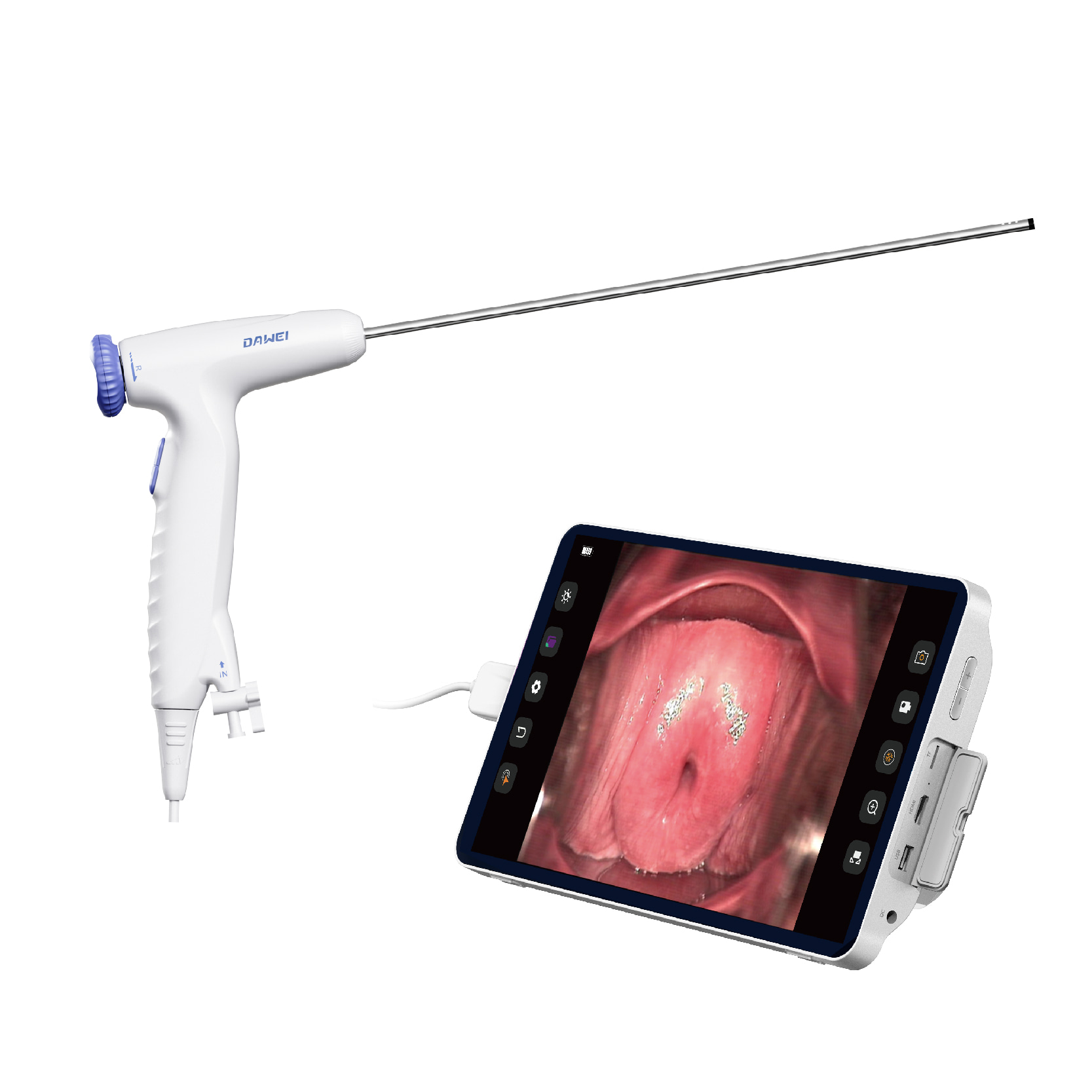 Dawei UT Series Disposable Electronic Hysteroscope