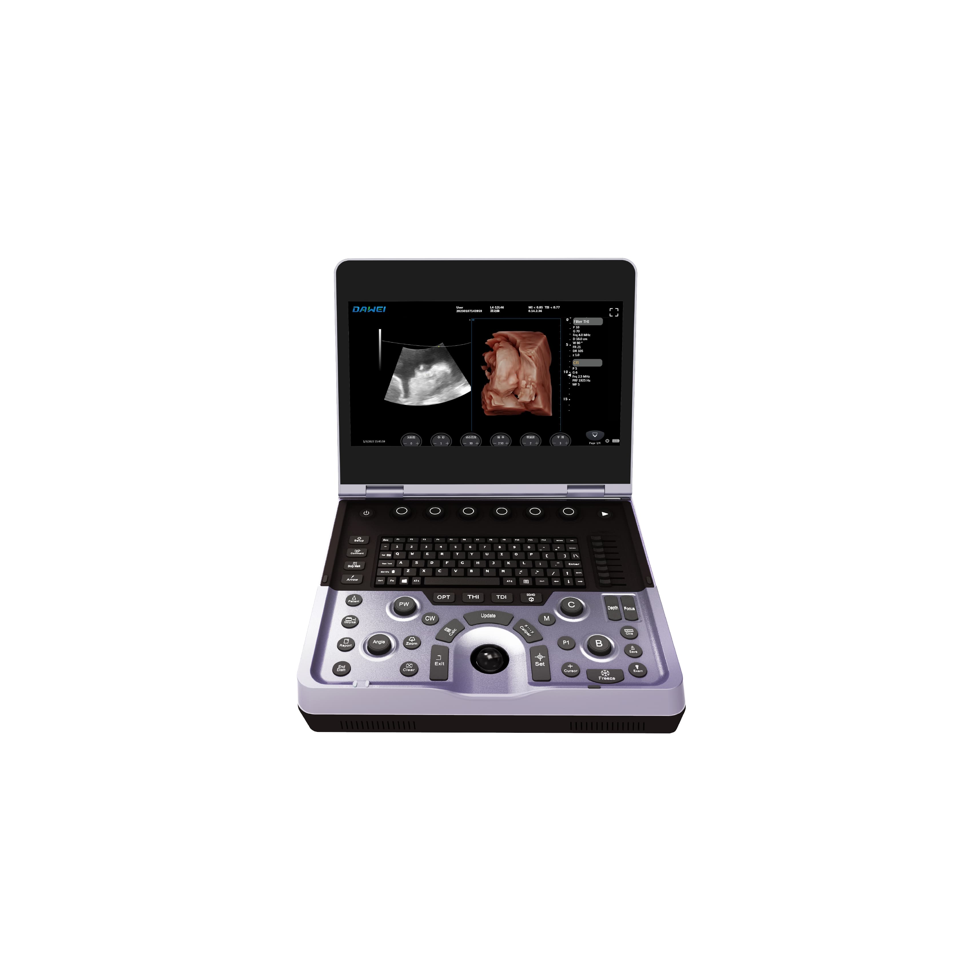 Laptop Color Doppler Ultrasound System
